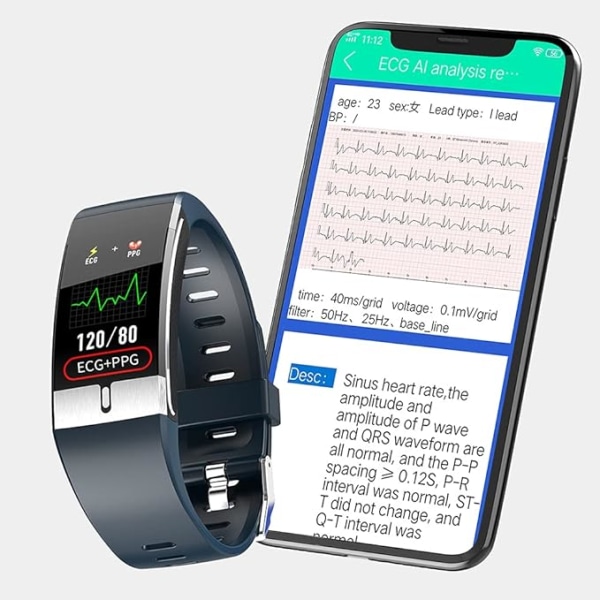 EKG smart watch (svart), IP68 vattentät fitness , med t