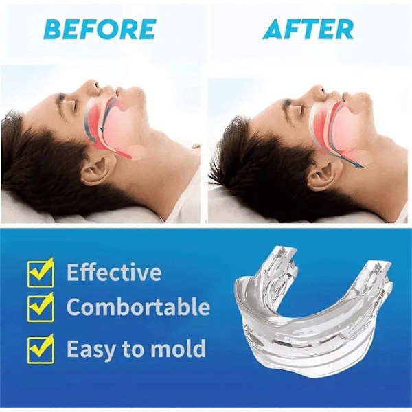 2 st Anti Snarkning Bruxism Munskydd Dental Ortodontiska Tandställning Tandskydd Sovande Bruxismo Snarkningsskydd