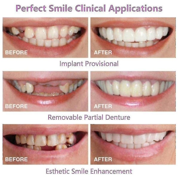 Smile seler Snap On øvre falske tænder Dental Finer Protese Cover Set
