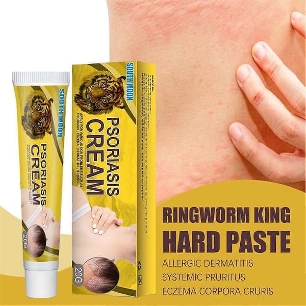 Psoriasis krem for bakteriostase dermatitt eksem kropp psoriasis hudpleie (2 stk)