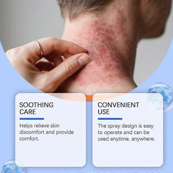 Magnesium Herbal Psoriasis Spray, Magnesium Herbs Hauts (4st)