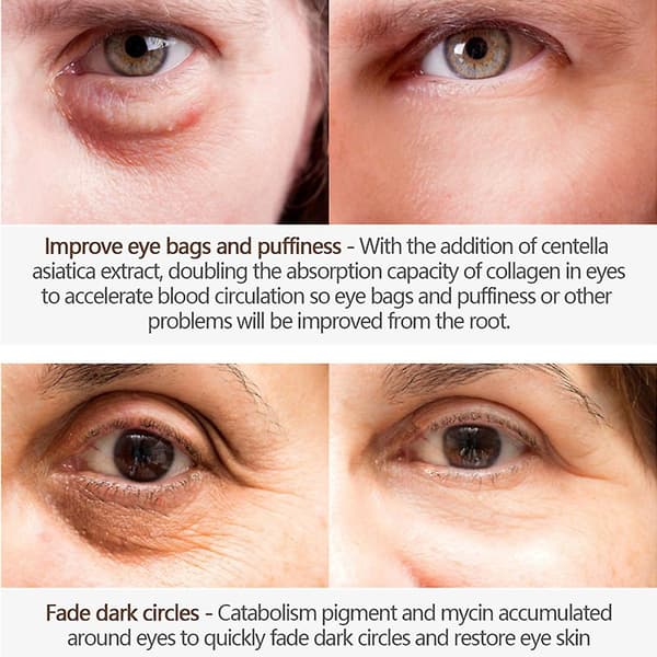 Ögonkräm Ögonessens Ögonfuktighetskräm Minskar Mörka Ringar Anti-Aging Lugnande A