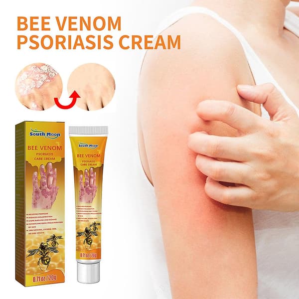 20g Hand Moss Remove Cream Effektiv Ringormskräm Hudvårdsprodukt A