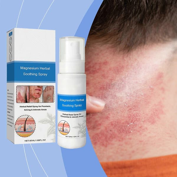 Magnesium Herbal Psoriasis Spray, Magnesium Herbs Hauts (4st)