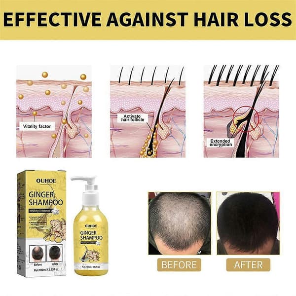 Ingefær Hårgenvækst Shampoo, Ingefær Reparationsshampoo, Ingefær Shampoo, Anti Hårtab Ingefær Shampoo (4 stk)
