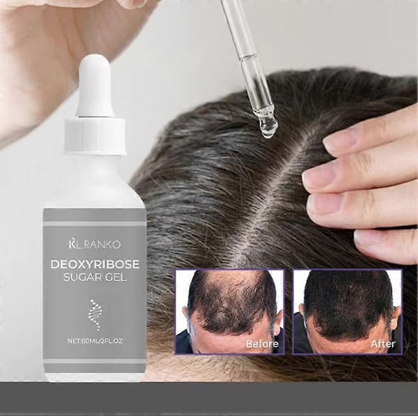 Deoxyribose Sugar Gel Hårväxtserum, Hårförtjockande Stärkande Förebygger Håravfall (2st)
