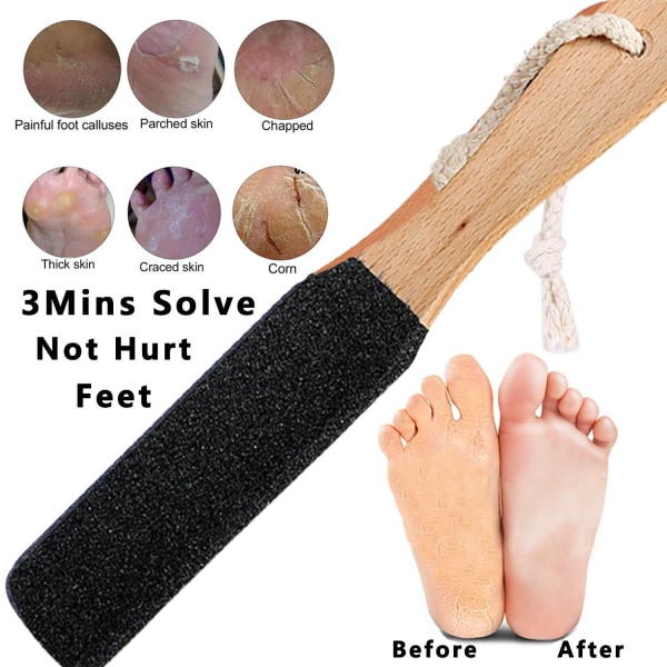 Foot File Callus Remover Jalkojen pesuri, poistaa halkeilut