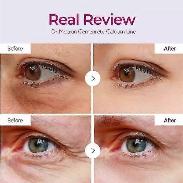 3X Dr.Melaxin Cemenrete Calcium Volume Multi Balm Wrinkle Core Stick K-beauty A