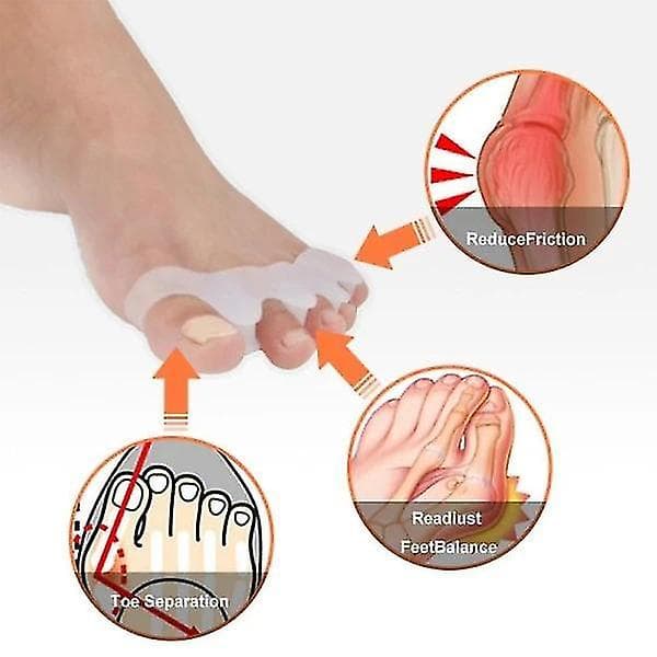 2 kpl Hallux Valgus varvaslevitin erottaa varpaat varvastuki varvaserotin A
