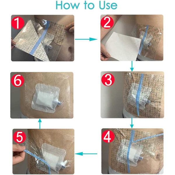 100 stk vanntette dusjdekselskjold for dialyseport Picc-linje brystkateter Pd peritoneal dialyse Chemo-port matesonde G-tube pasientsdusj