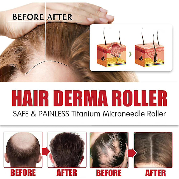 Hiusten Derma Roller 600 titaanimikroneula Roller Hiusten uudistuminen Kasvu Päänahan hieroja