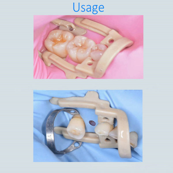 IC 1Box Dental Gummiklämma Distal-Extension Gummiduk Barriär