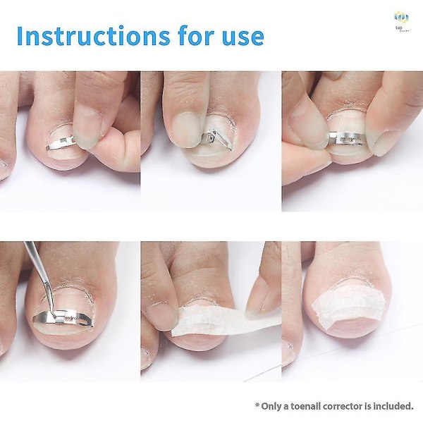 Inngrodd tåneglekorrigering Behandlingsverktøy for tåneglkorrigering Foot Negle Care Tool
