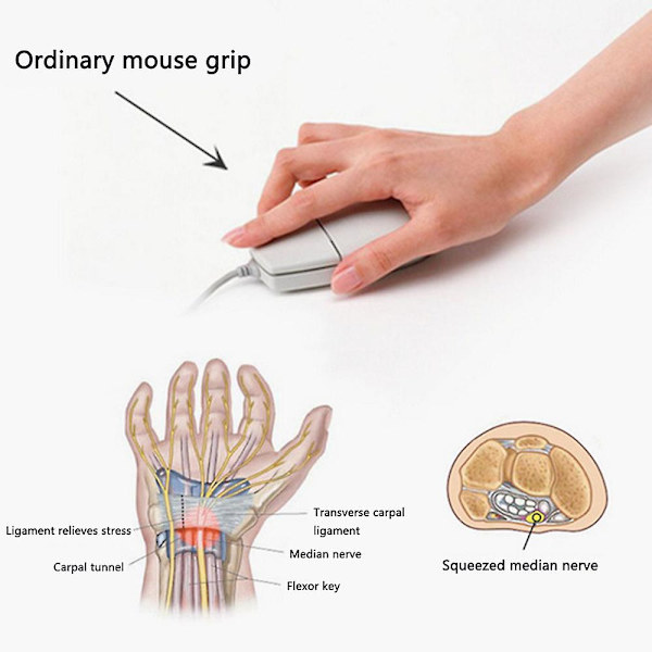Trådbunden vertikal mus, liten ergonomisk mus med hög precision optisk möss med justerbar känslighet 800/1200 /1600 Dpi, 6 knappar, för små händer red