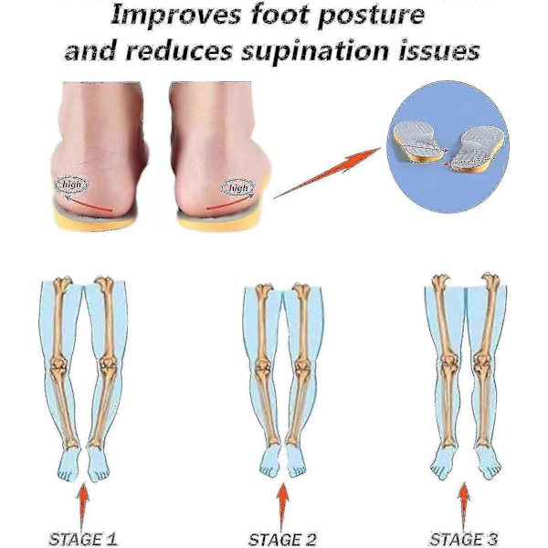 Supinationssulor för översupination & högt fotvalv, ortopediska inlägg för fotinriktning, knackeknä, kobenta, O/X-benthet Size  43-45