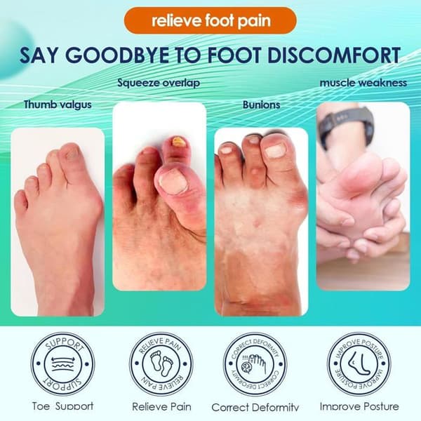 1 par Hallux Valgus-korrigerer, justerbar natt- og dag-tåskiller for hallux valgus-bunion for kvinner og menn