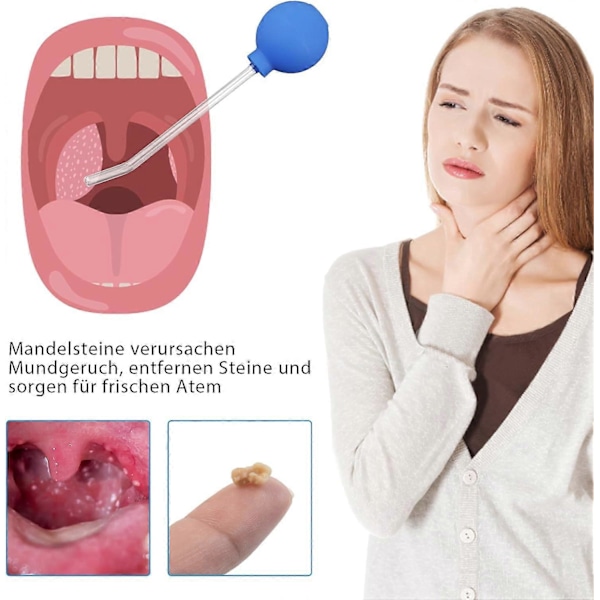 Mandstenfjerner, Mandstenfjernelsessæt, Sugeglas til Mandler, Mandstenfjerner med Sugehoved & Tandlægespejl