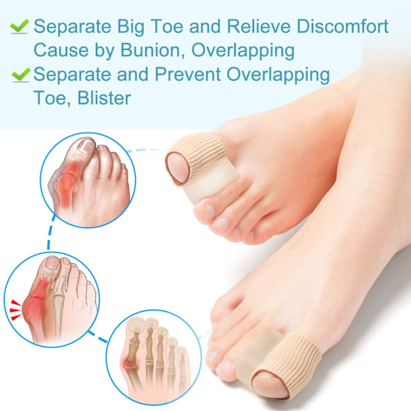 6 Pakning Gel Tåseparatorer (1,5 cm Tykk), Hallux Valgus Korreksjon for Overlappende Tær (1./2. Tå), Silikon Tåseparatorer med Mykt Gel Fôr for Hallu