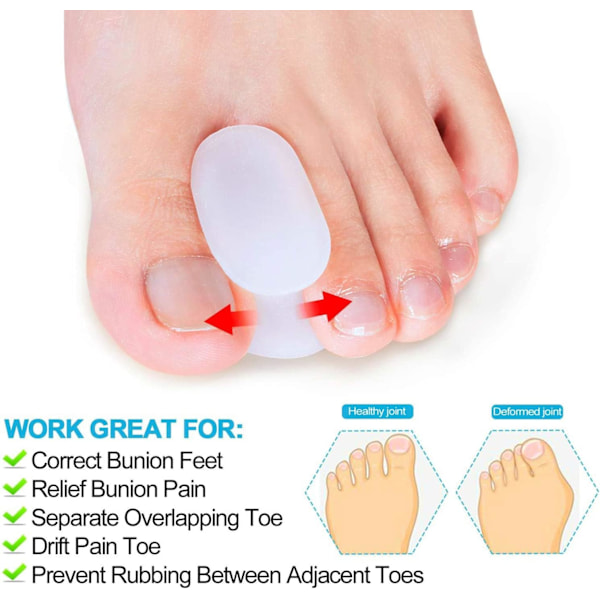 10 Pakke Tåspredere Separatorer, Hallux Valgus Korrigerende Gel Ortopediske Innlegg (1/2'' Tykk) for Hallux Valgus, Overlappende Tær - L Størrelse