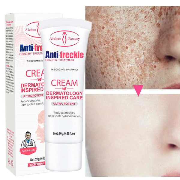20g Whitening Freckle Cream Ta bort mörka fläckar 1PC