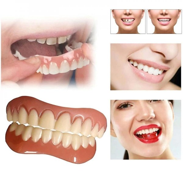 Kosmetisk tandprotesfasader med falska tänder för tandfasader för över- och underkäke för tillfällig tandrestaurering Natur och komfort Upper and Lower