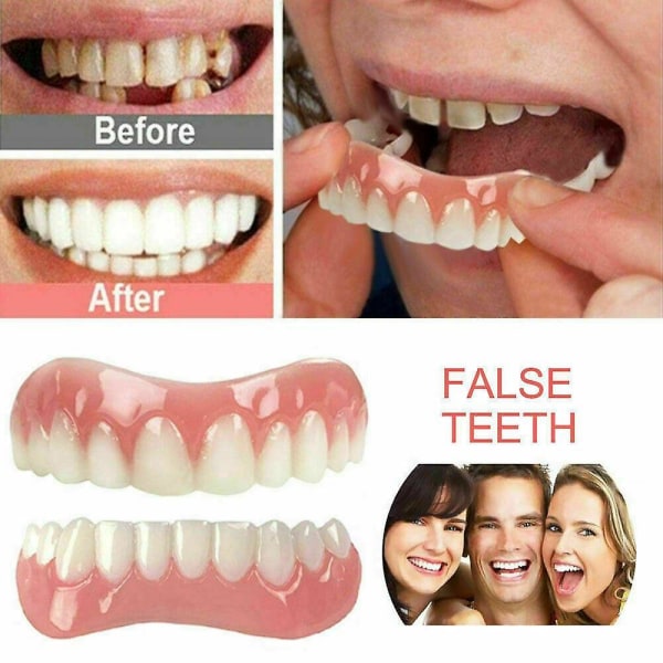 Viilut Tekohampaat napsahtavat välittömästi Smile viilut Kosmeettiset hampaat Hammasproteesit Hammashoito