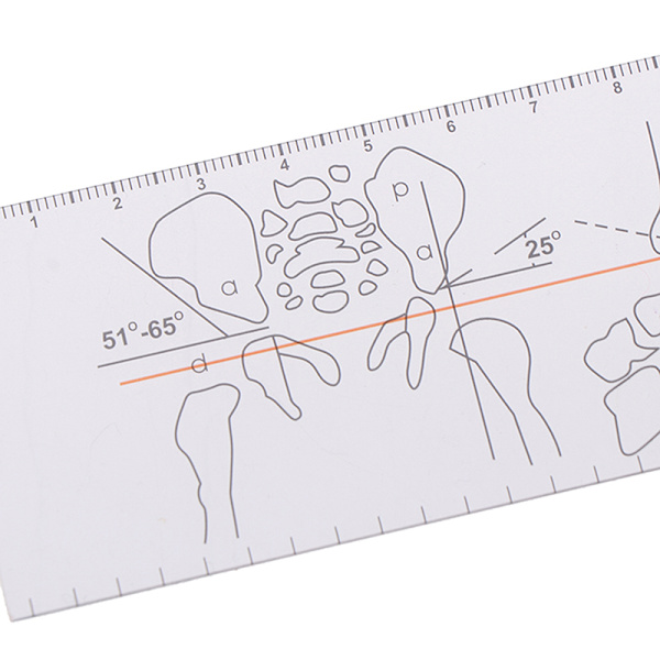 Multi-linjal Goniometer Vinkellinjal Ortopedi verktygsinstrument 1pc
