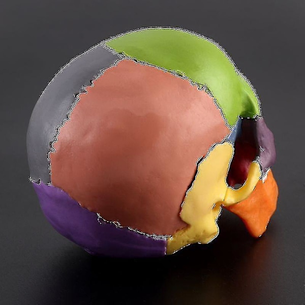 4d Demonterad Färg Skalle Anatomisk Modell Avtagbart Läroverktyg