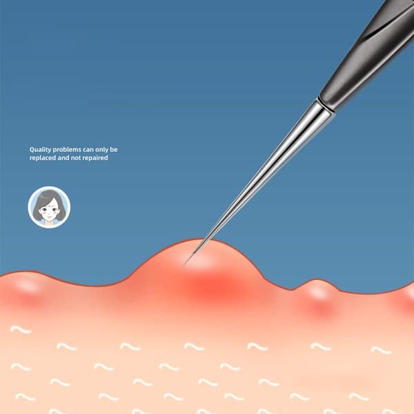 Blackhead Removal Tool Kit - 2-Pack Blackhead and Pimple Removal Tools