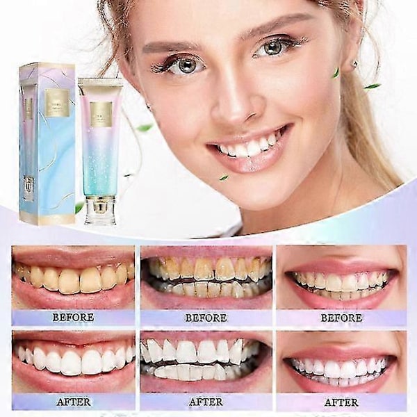 Niacinamid Dazzle White Tandkräm, Body Accel Niacinamid Whitening Tandkräm, Frisk Andedräktstandkräm
