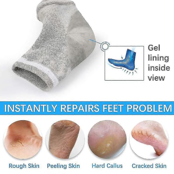 Moisturizing Socks - Gel Heel Socks for Dry Cracked Heels