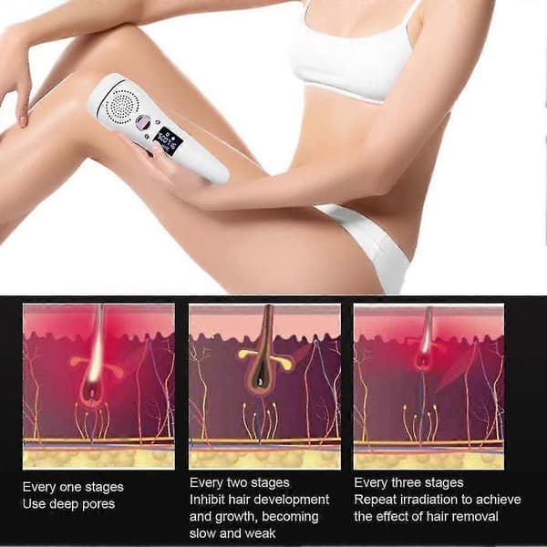 Professionel IPL Smertefri Epilator til Krop og Ansigt (Hvid)