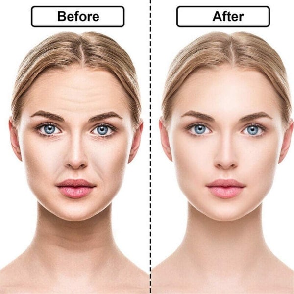 IC Face Patch Anti Aging - Beskyttelse mod rynker i panden, øjenrynker