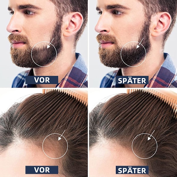 Koi Beauty Derma Roller kasvoille, hiusten ja parran kasvulle