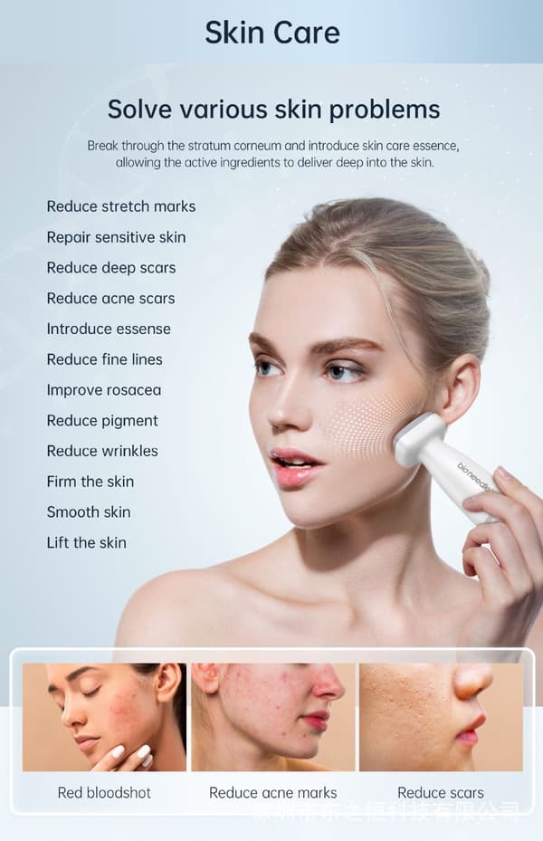 Til Bioneedle Derma Stamp 120 Titanium Microneedling Stamp Justerbar dermastamp 0-2