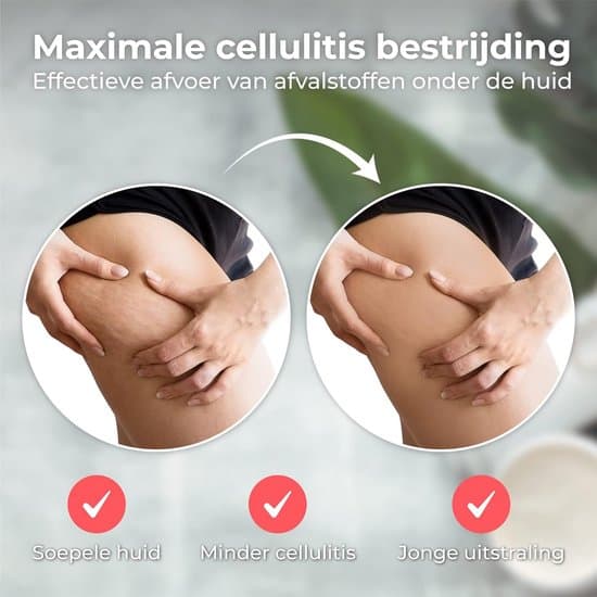 Cellulitmassageapparat - Anti-cellulitenhet - Koppningskoppar - Hudvård