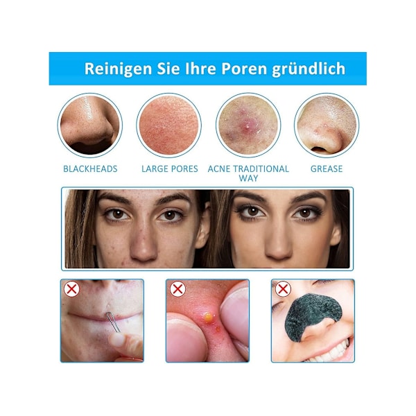 Ny Elektrisk Pormask Sugenhet Akne Pormask Porrengörare Hudvisualisering Skönhetsenhet. Roséguld YEMAESRE