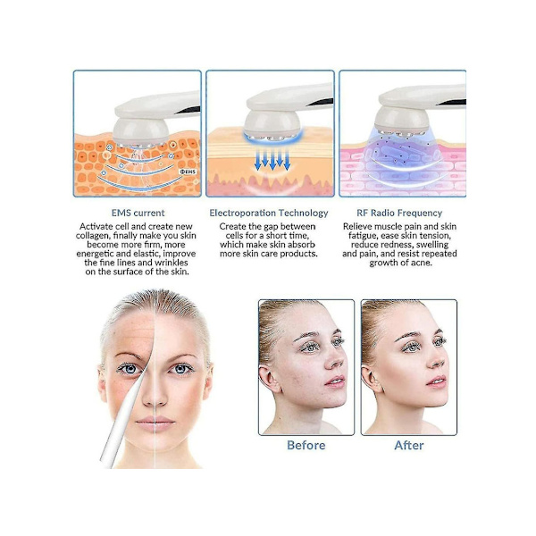 Ansiktsmassage Anti-Aging Rynkor Uppstramande Lyftmaskin Vit YEMAESRE