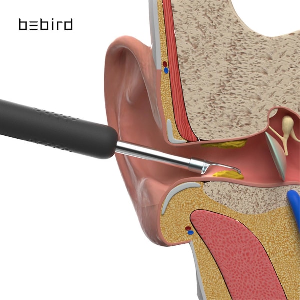 Bebird Earpicks Öronvaxborttagningsverktyg med LED-ljus Visual Earpick Öronsked Öronrengöring för öron Hälsovård Öronrengöringsverktyg