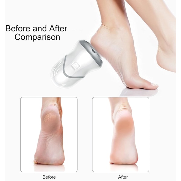 Foot File Electric Set Ladattava vedenpitävä kovan ihon poistoaine jalkojen hoitoon
