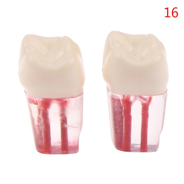 2 st Resin Dental Endodontisk tand Modell Endo rotkanalfiler