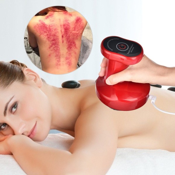 Elektrisk cupping massager skrabe sugekop massager