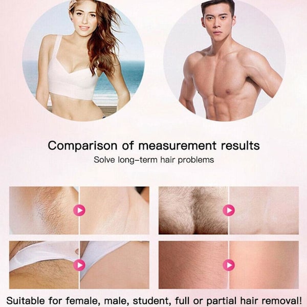 2023 Parhaat 5minskin Kotikäyttöön Sopiva Hiustenpoistokäyttölaite 5minskin New H black One-size
