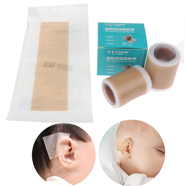 Baby ørekorrektorer Silikonetape Spædbørns ørekorrektion 4cm*100cm