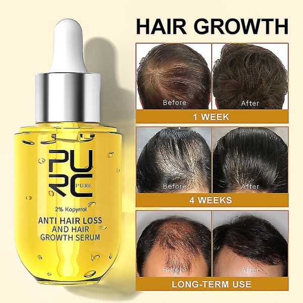 Purc Hiustenkasvutuotteet Inkivääri Fast Growth Oil Anti Hair Loss Treatment Essence Ravitseva Kauneus Terveys Miehille Naisille Hiustenhoito