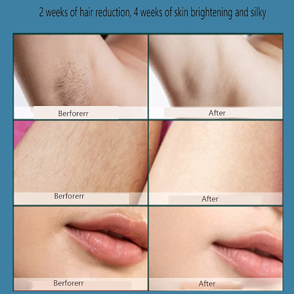 Hår fjernelse hårfjerning IPL system epilator husholdning fuld