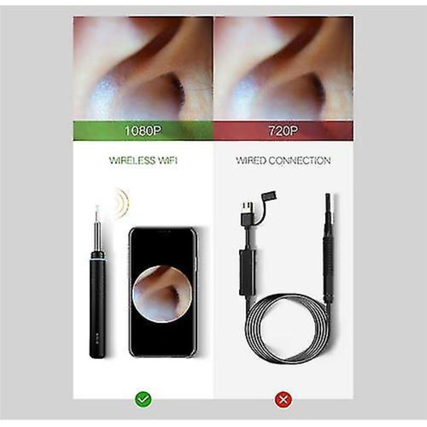 Bebird M9 Pro Otoscope Smart Visual Ear Cleaning Stick 1080p HD digitaalisella endoskoopilla (musta)