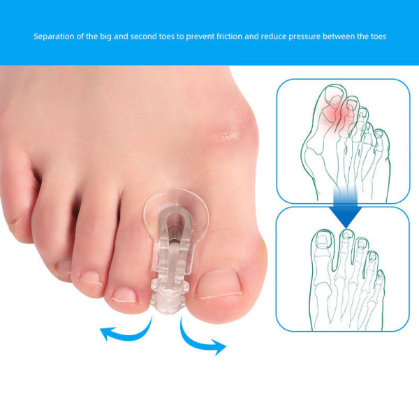 Tådelare Tummen Valgus Corrector Big Foot Bone Orthosis Clip