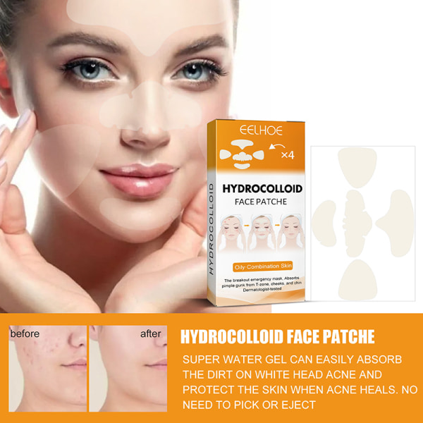 20st Hydrokolloidplåster Ansiktsmask Acne Pimple Zit For Nose 8e64 | Fyndiq