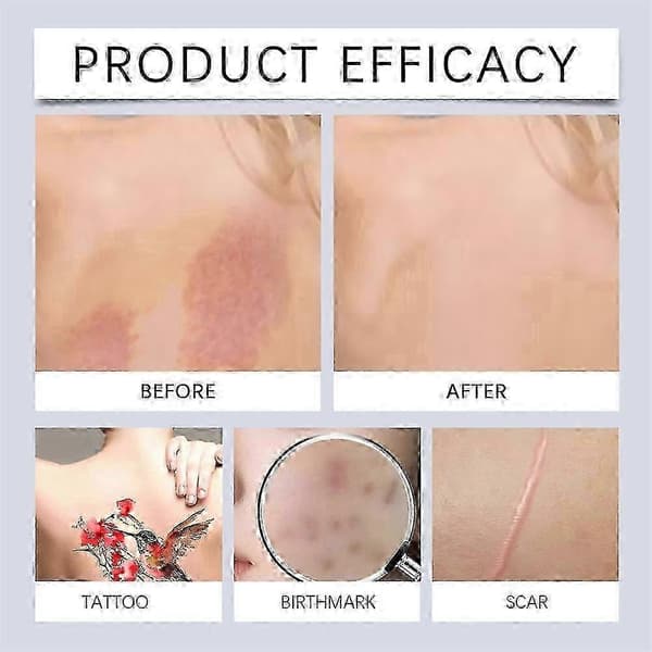 Vattentät täckande concealer-kräm för vitiligo, tatueringar, ärr och mörka fläckar